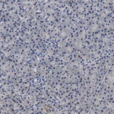 Immunohistochemistry-Paraffin: UQCRC2 Antibody [NBP1-80861]