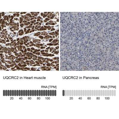 Immunohistochemistry-Paraffin: UQCRC2 Antibody [NBP1-80861]