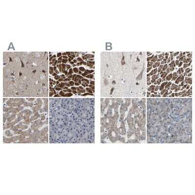 Immunohistochemistry-Paraffin: UQCRC2 Antibody [NBP1-80861]