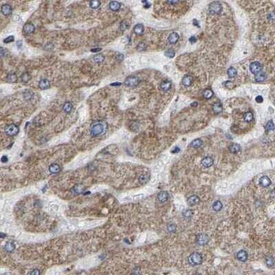 Immunohistochemistry-Paraffin: UQCRC2 Antibody [NBP1-80861]