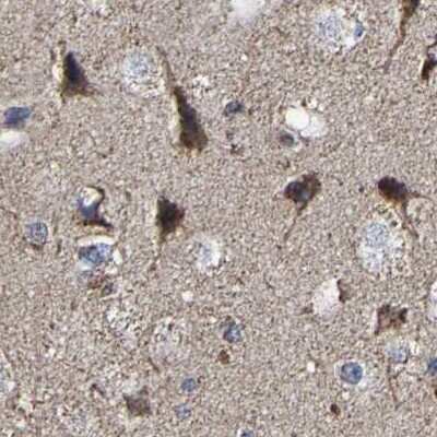Immunohistochemistry-Paraffin: UQCRC2 Antibody [NBP1-80861]