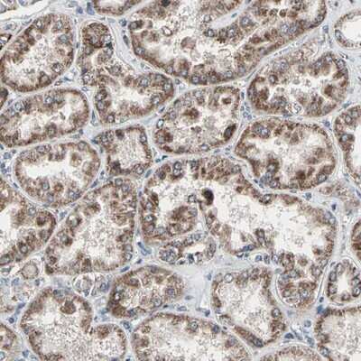 Immunohistochemistry-Paraffin: UQCRC2 Antibody [NBP1-80862]