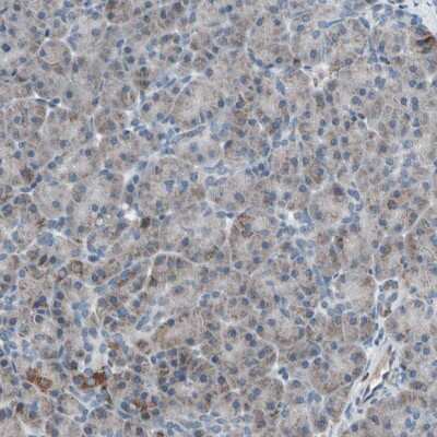 Immunohistochemistry-Paraffin: UQCRC2 Antibody [NBP1-80862]