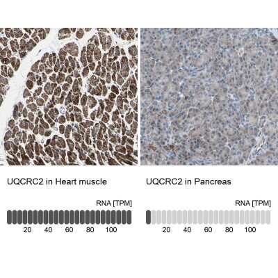 Immunohistochemistry-Paraffin: UQCRC2 Antibody [NBP1-80862]