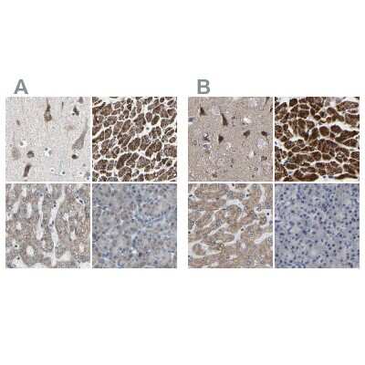 Immunohistochemistry-Paraffin: UQCRC2 Antibody [NBP1-80862]
