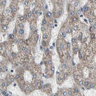Immunohistochemistry-Paraffin: UQCRC2 Antibody [NBP1-80862]