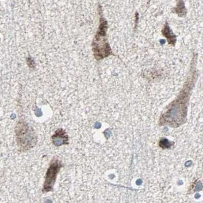 Immunohistochemistry-Paraffin: UQCRC2 Antibody [NBP1-80862]