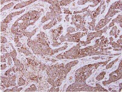 Immunohistochemistry-Paraffin: UQCRC2 Antibody [NBP2-20816]