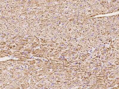 Immunohistochemistry-Paraffin: UQCRC2 Antibody [NBP2-97364]