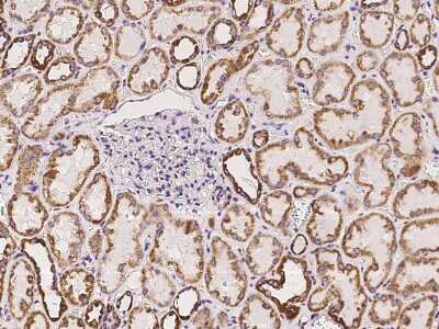 Immunohistochemistry-Paraffin: UQCRC2 Antibody [NBP2-97364]