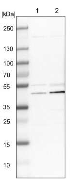 Western Blot: UQCRC2 Antibody [NBP1-80861]