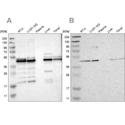 Western Blot: UQCRC2 Antibody [NBP1-80861]
