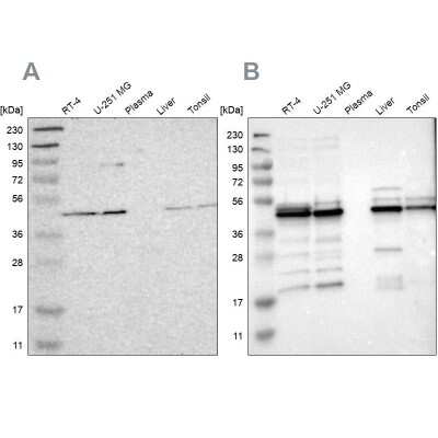 Western Blot: UQCRC2 Antibody [NBP1-80862]