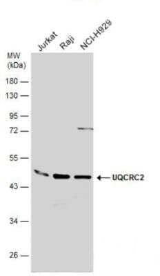 Western Blot: UQCRC2 Antibody [NBP2-20816]