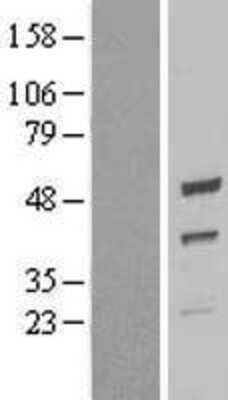 Western Blot: UQCRC2 Overexpression Lysate [NBL1-17630]