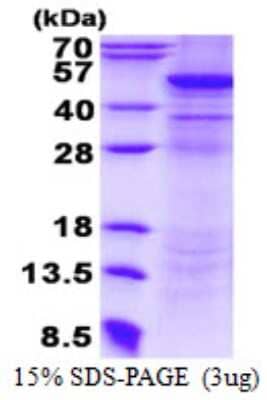 SDS-PAGE: Recombinant Human UQCRC2 His Protein [NBP2-22916]