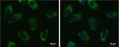 Immunocytochemistry/ Immunofluorescence: UQCRFS1 Antibody [NBP1-32367]