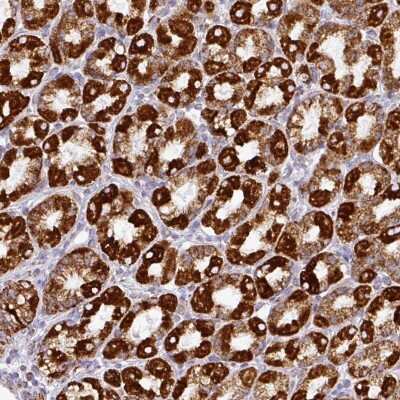 Immunohistochemistry: UQCRFS1 Antibody [NBP2-38623]