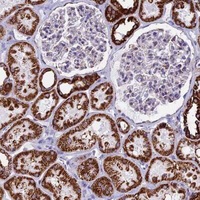 Immunohistochemistry-Paraffin: UQCRFS1 Antibody [NBP1-87826]