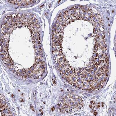 Immunohistochemistry-Paraffin: UQCRFS1 Antibody [NBP1-87826]