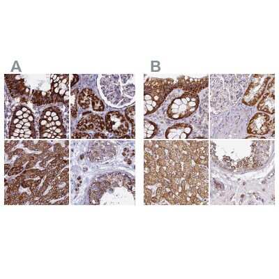 Immunohistochemistry-Paraffin: UQCRFS1 Antibody [NBP1-87826]