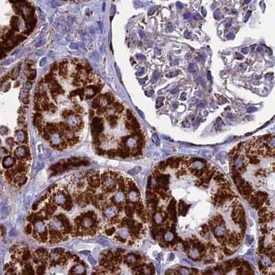 Immunohistochemistry-Paraffin: UQCRFS1 Antibody [NBP1-87826]