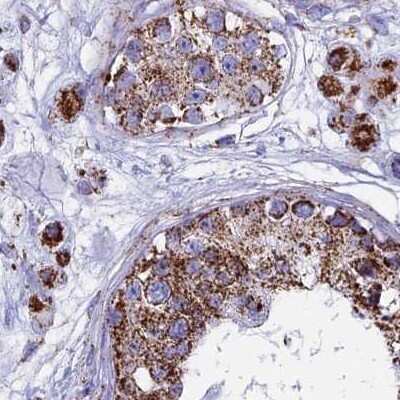 Immunohistochemistry-Paraffin: UQCRFS1 Antibody [NBP1-87826]