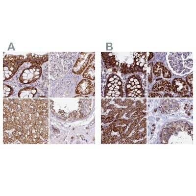 Immunohistochemistry-Paraffin: UQCRFS1 Antibody [NBP2-38623]