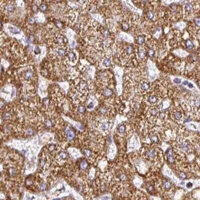Immunohistochemistry-Paraffin: UQCRFS1 Antibody [NBP2-38623]