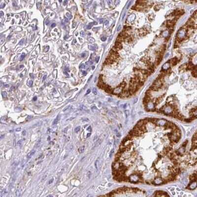 Immunohistochemistry-Paraffin: UQCRFS1 Antibody [NBP2-38623]