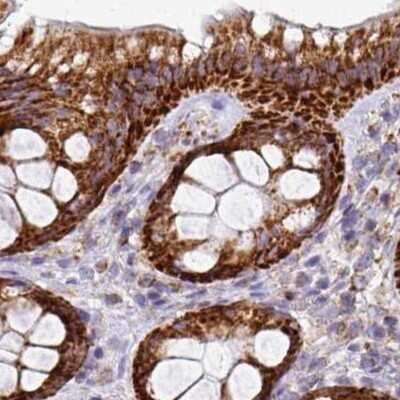 Immunohistochemistry-Paraffin: UQCRFS1 Antibody [NBP2-38623]