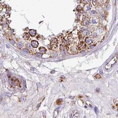 Immunohistochemistry-Paraffin: UQCRFS1 Antibody [NBP2-38623]