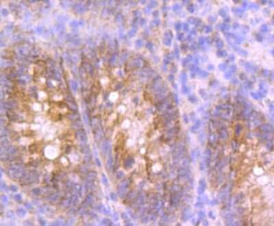 Immunohistochemistry-Paraffin: UQCRFS1 Antibody (JG62-31) [NBP2-75697]