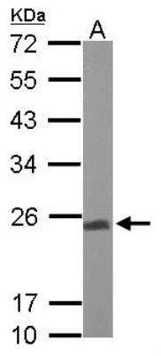Western Blot: UQCRFS1 Antibody [NBP1-32367]