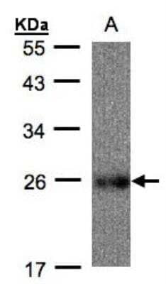 Western Blot: UQCRFS1 Antibody [NBP1-32367]