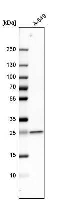 Western Blot: UQCRFS1 Antibody [NBP1-87826]