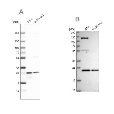 Western Blot: UQCRFS1 Antibody [NBP1-87826]