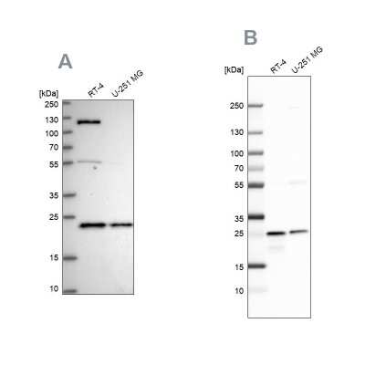 Western Blot: UQCRFS1 Antibody [NBP2-38623]