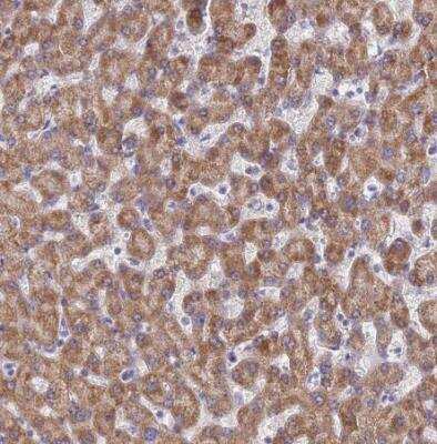 Immunohistochemistry-Paraffin: UQCRH Antibody [NBP1-93442]