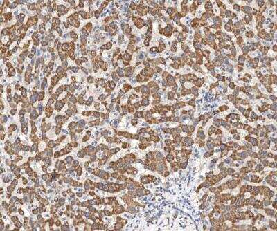 Immunohistochemistry-Paraffin: UQCRH Antibody [NBP3-12568]