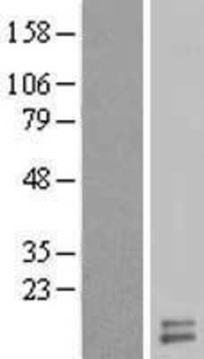 Western Blot: UQCRH Overexpression Lysate [NBL1-17631]