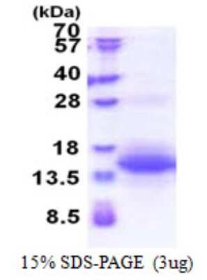 SDS-PAGE: Recombinant Human UQCRH His Protein [NBP2-22917]