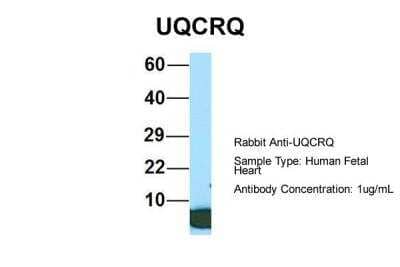 Western Blot: UQCRQ Antibody [NBP2-86043]
