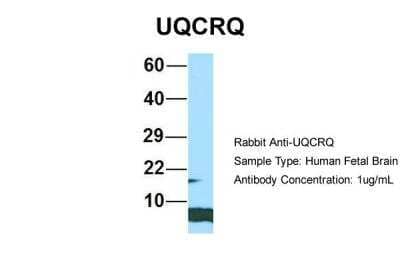 Western Blot: UQCRQ Antibody [NBP2-86043]