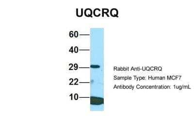 Western Blot: UQCRQ Antibody [NBP2-86043]