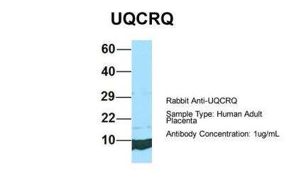 Western Blot: UQCRQ Antibody [NBP2-86043]