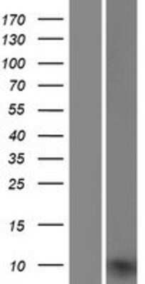 Western Blot: UQCRQ Overexpression Lysate [NBP2-07342]