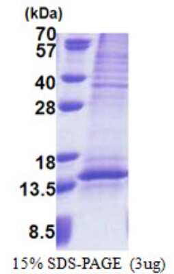 SDS-PAGE: Recombinant Human UQCRQ His Protein [NBP2-22918]