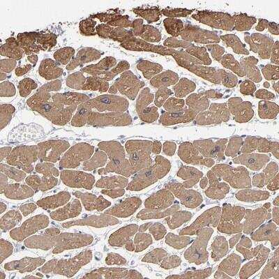 Immunohistochemistry-Paraffin: URB/CCD80 Antibody [NBP1-87965]