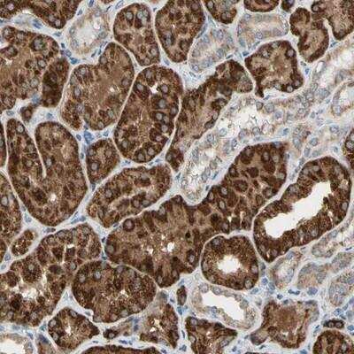 Immunohistochemistry-Paraffin: URB2 Antibody [NBP1-93655]